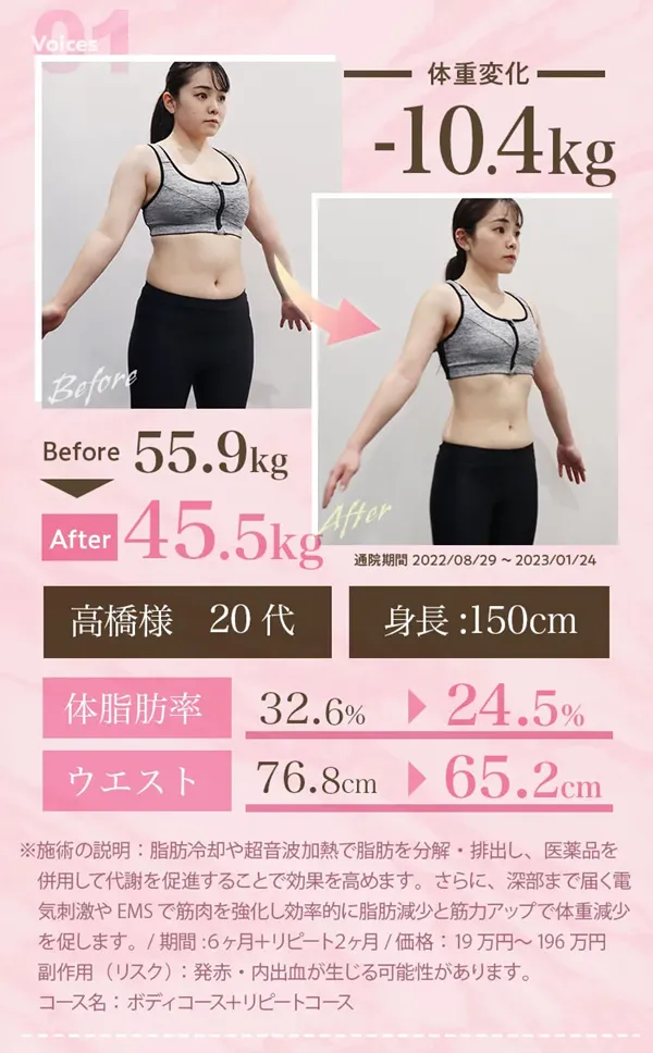 脂肪冷却のキャンペーン一覧！モニター無料　症例写真1