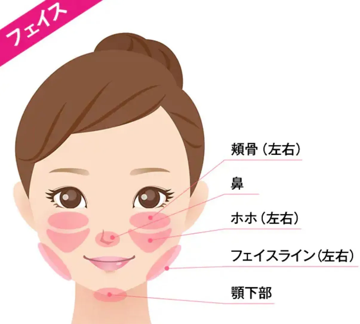 湘南美容クリニックの脂肪溶解注射(BNLSアルティメット)の顔の対応可能箇所