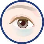 TCBのクマ取り施術　青クマのイメージ