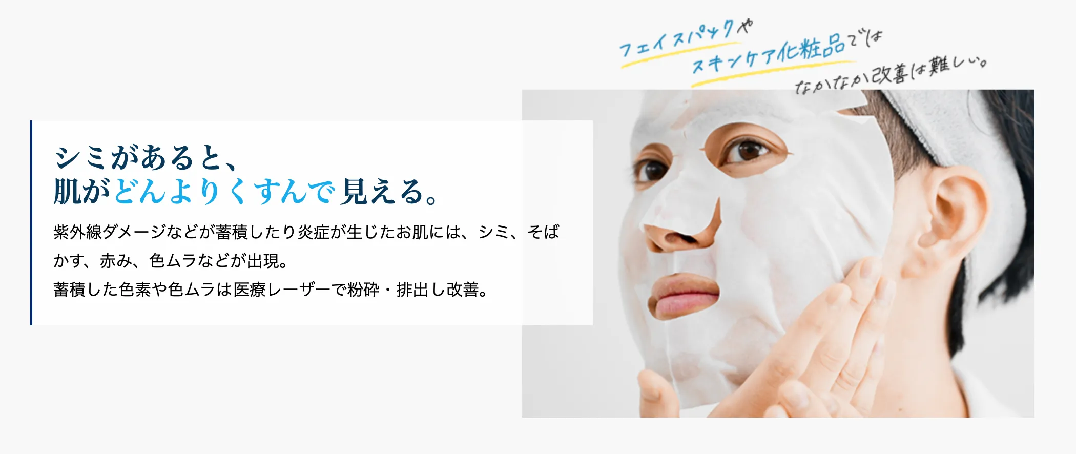 湘南美容クリニックのメンズシミ取りについて