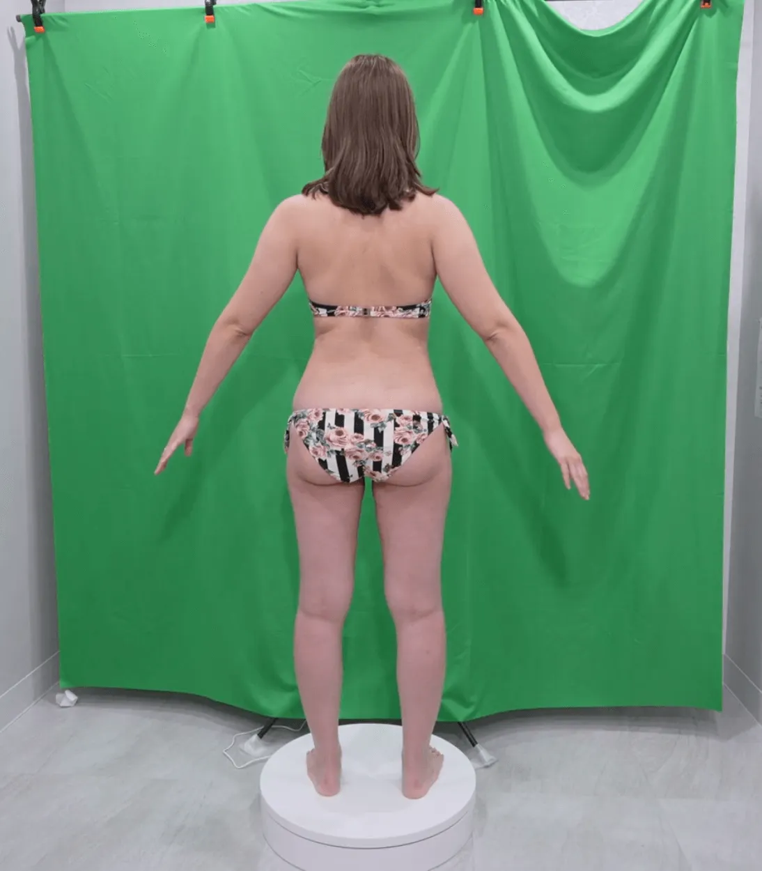 施術前画像(背面)