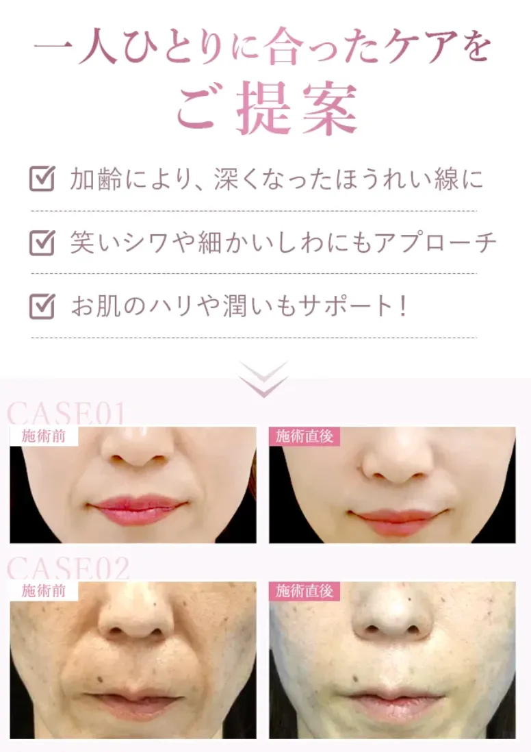 石川(金沢)でヒアルロン酸注射ができるおすすめのクリニック TCBの選ばれる理由