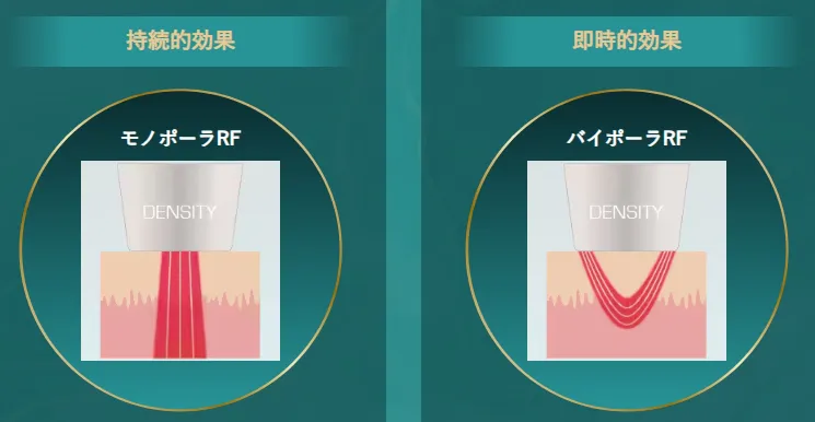 神戸でデンシティが安いおすすめのクリニック 湘南美容クリニックのLP画像 治療詳細