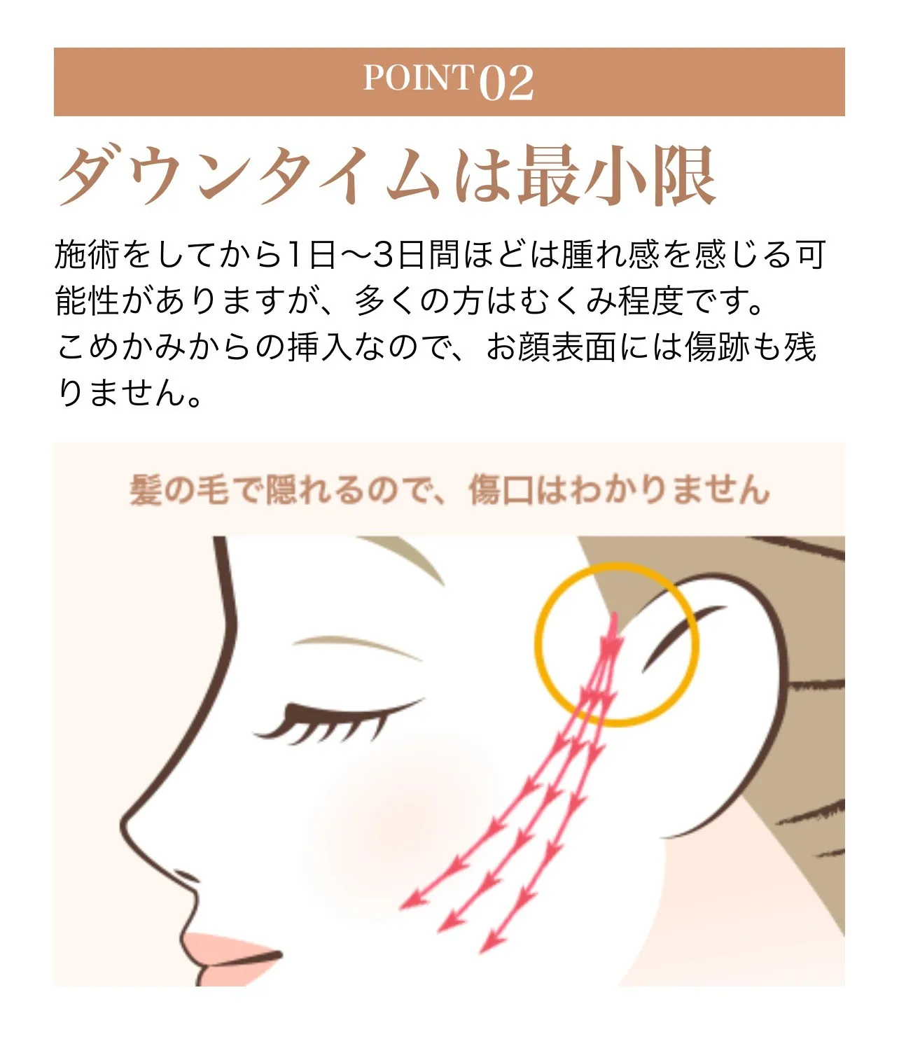 湘南美容クリニックの糸リフトのダウンタイムは最小限