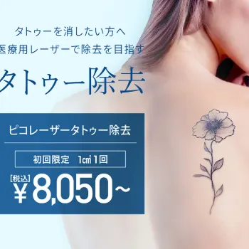TCB東京中央美容外科のタトゥー除去
