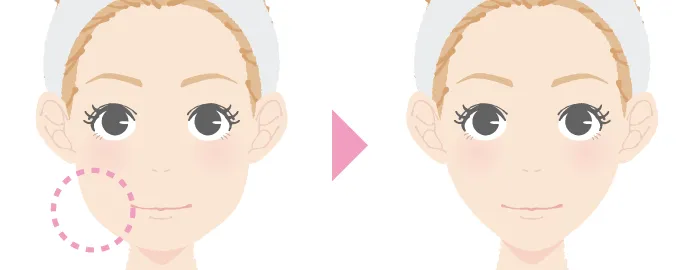 TCB エラボトックス とは