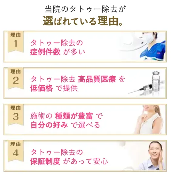 SBCのタトゥー除去が選ばれる理由