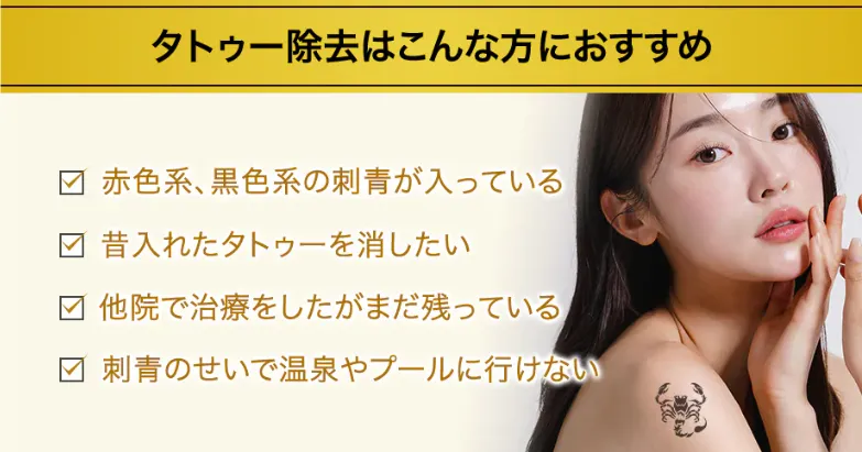 名古屋でタトゥー除去(刺青除去)が安いおすすめクリニックである湘南美容クリニックのおすすめな人