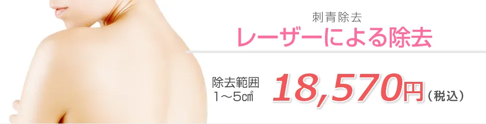 名古屋でタトゥー除去(刺青除去)が安いおすすめクリニックである湘南美容クリニックのレーザー治療料金