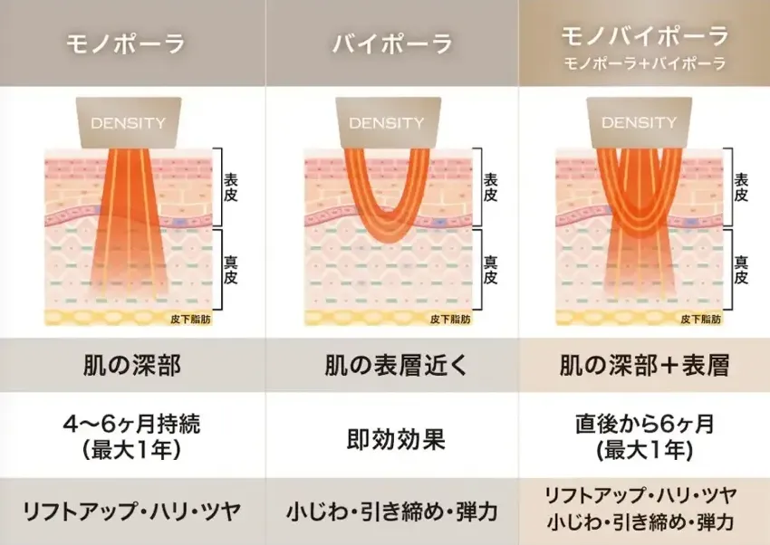 札幌でデンシティが安い湘南美容クリニックのおすすめ 施術内容