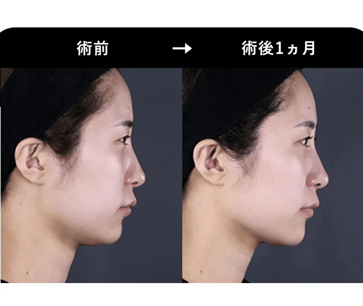 SBCの医療ハイフの症例