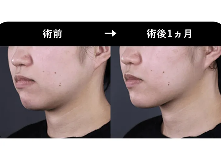 SBCの医療ハイフの症例