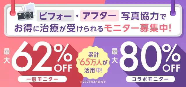 湘南美容クリニックのメンズシワ取り(ほうれい線)はモニターがお得