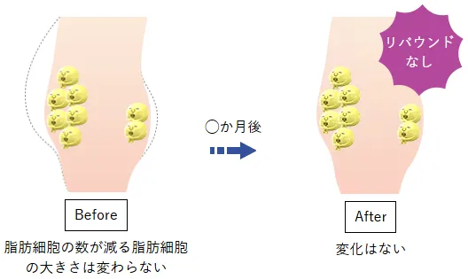 湘南美容クリニックのメディカルサイズダウンでは主に、脂肪細胞を冷却して破壊するクールスカルプティング® エリートを使用