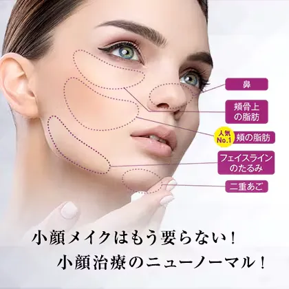 BNLS アルティメット