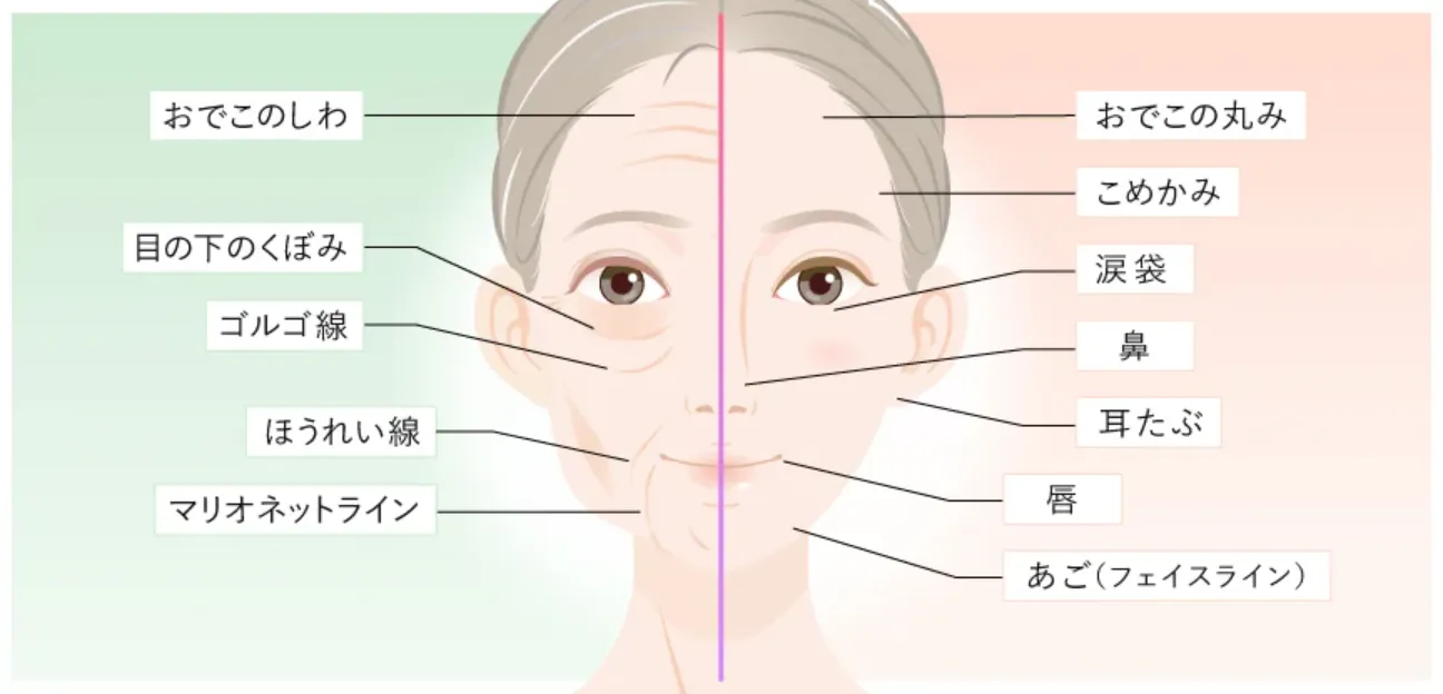 東京でヒアルロン酸注射ができるおすすめのクリニックTCBの施術箇所