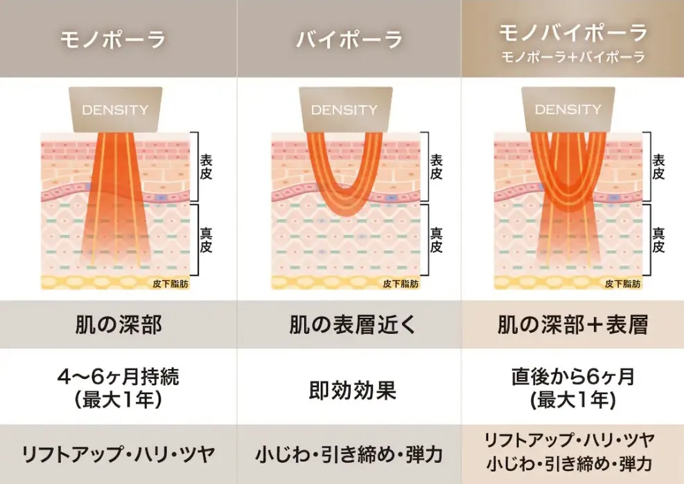 湘南美容クリニックのデンシティ施術内容