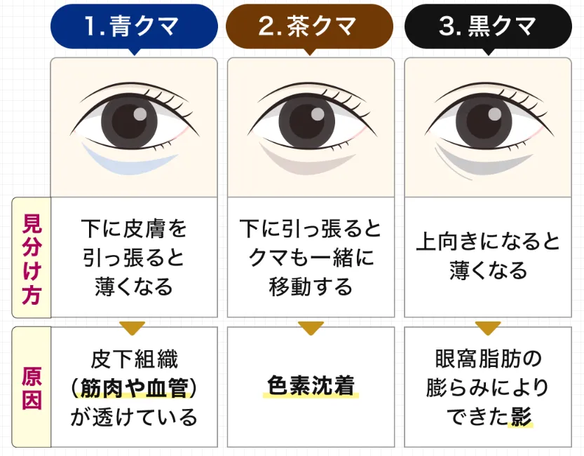 新宿美容外科クリニック立川院の口コミ評判【体験レポ】|3種類のクマ