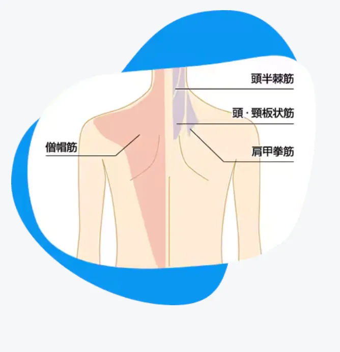 湘南美容クリニック(旧:湘南美容外科)の肩ボトックスの詳細説明