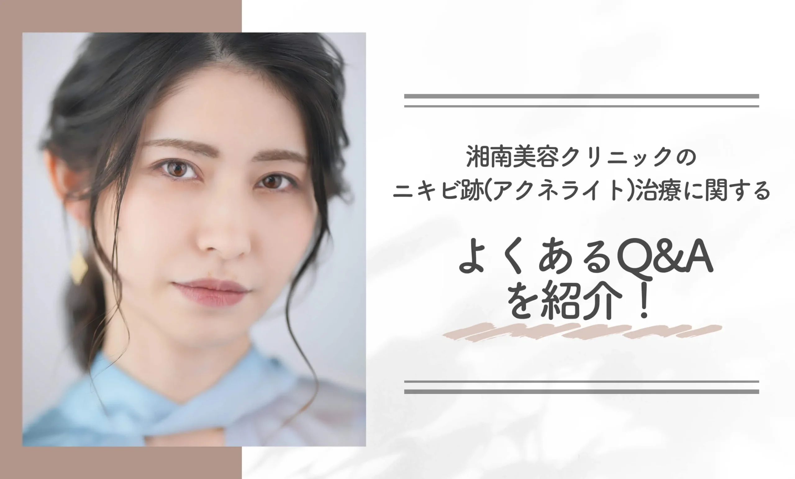 湘南美容クリニックのフォトトリプルの口コミ評判【知恵袋超え！】に関するよくあるQ&Aを紹介！