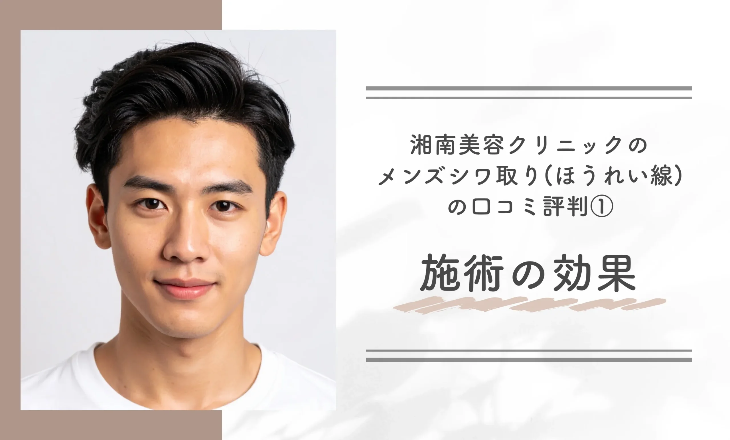 湘南美容クリニックのメンズシワ取り(ほうれい線)の口コミ評判①施術の効果