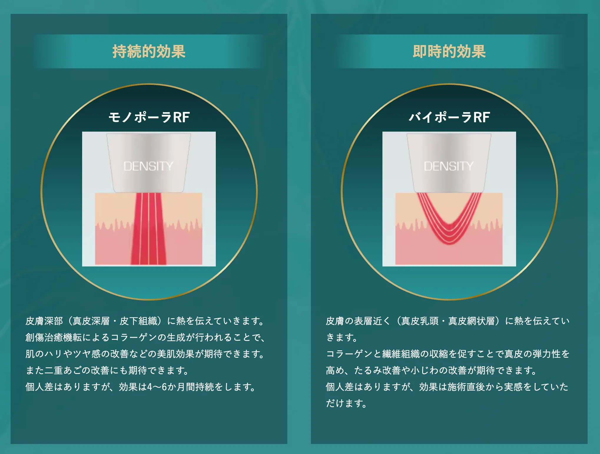 新潟にある湘南美容クリニックのデンシティの基礎知識