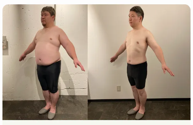 医療ダイエットの症例写真