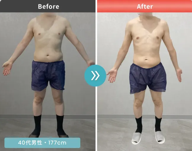 医療ダイエット症例①