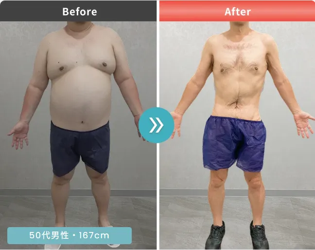 医療ダイエット症例②