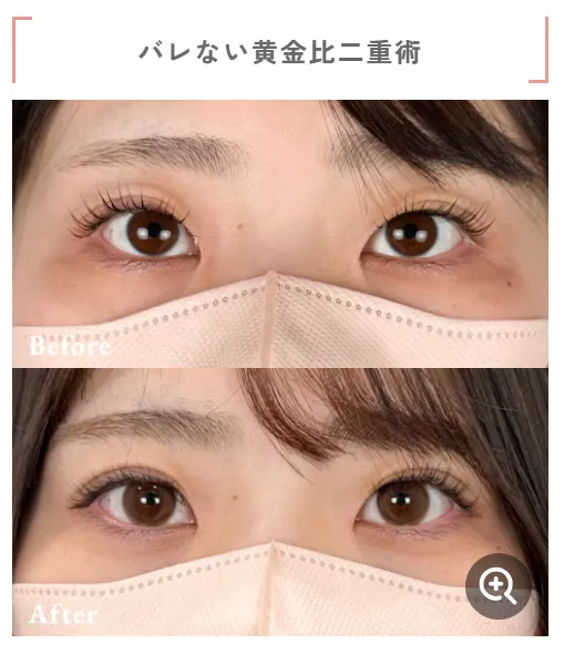 口コミで話題のTクリニック相良卓哉医師による症例写真③