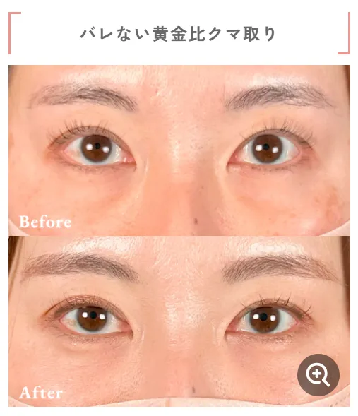 口コミで話題のTクリニック相良卓哉医師による症例写真②