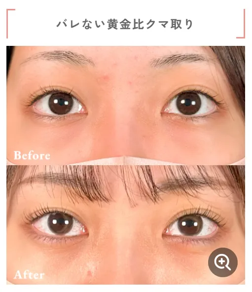 口コミで話題のTクリニック相良卓哉医師による症例①