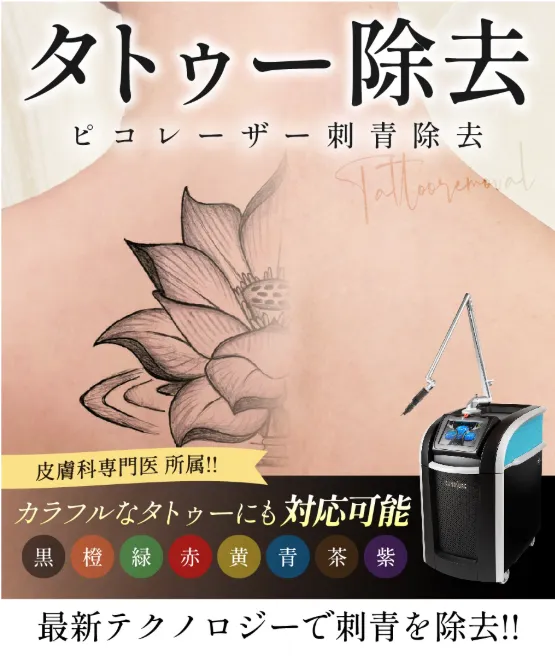 名古屋でタトゥー除去(刺青除去)が安いおすすめクリニックである湘南美容クリニックの広告③