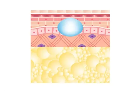 ヒアルロン酸注入後のイメージ画像