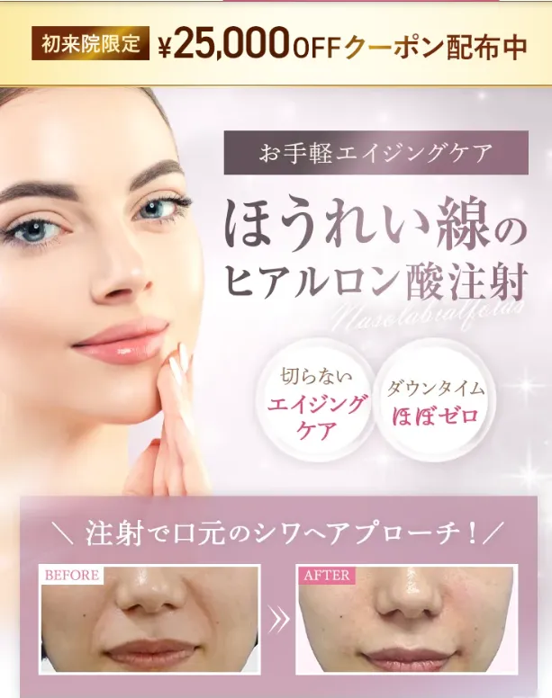 TCBのヒアルロン酸注射が無料