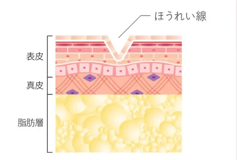 ヒアルロン酸注入前のイメージ画像