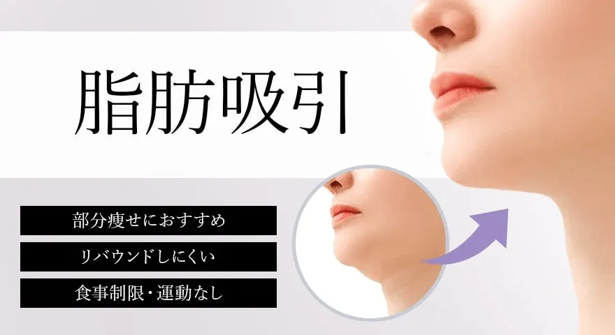 モニターで無料で受けられる脂肪吸引のイメージ画像