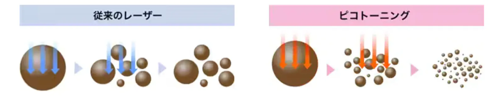 名古屋でピコトーニングが安いおすすめのクリニック湘南美容クリニック 施術内容