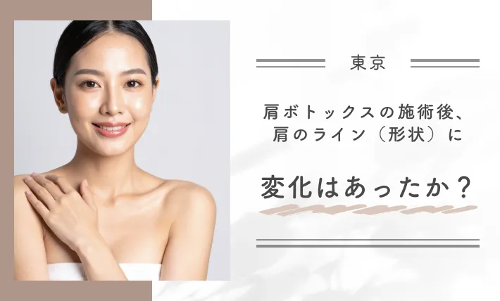 Q: 肩ボトックスの施術後、肩のライン(形状)に変化はあったか?