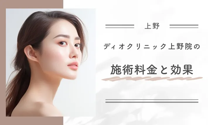 ディオクリニック上野院の施術料金と効果