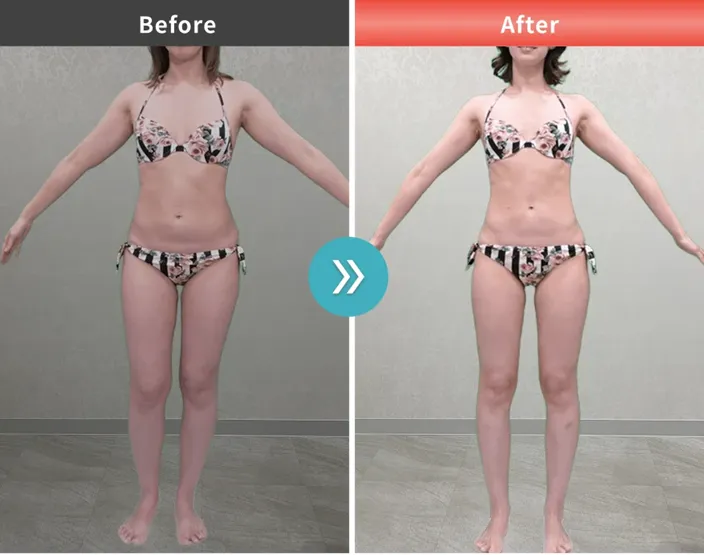 URARAクリニックオリジナルのプロテイン•効果高いって本当？専門家が徹底調査　症例写真③