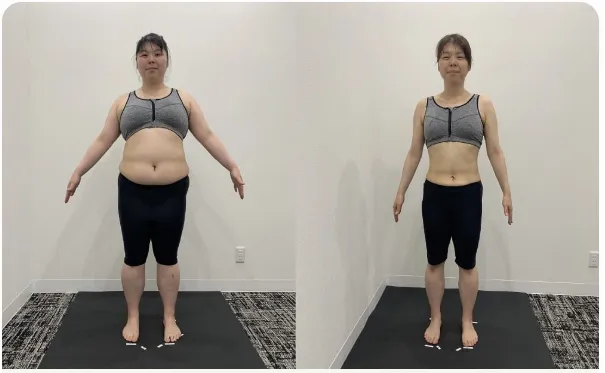 女性の症例写真