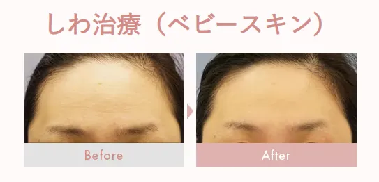 福岡でイオン導入がおすすめの湘南美容クリニックの症例写真