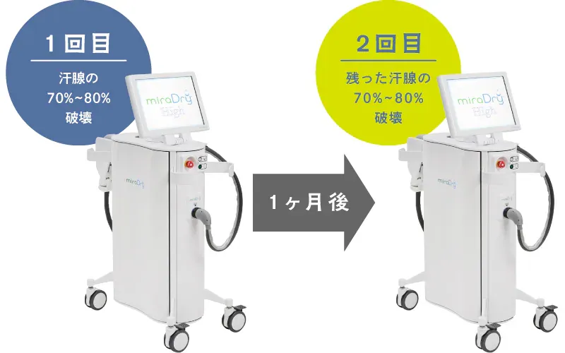 石川/金沢でおすすめなミラドライの効果