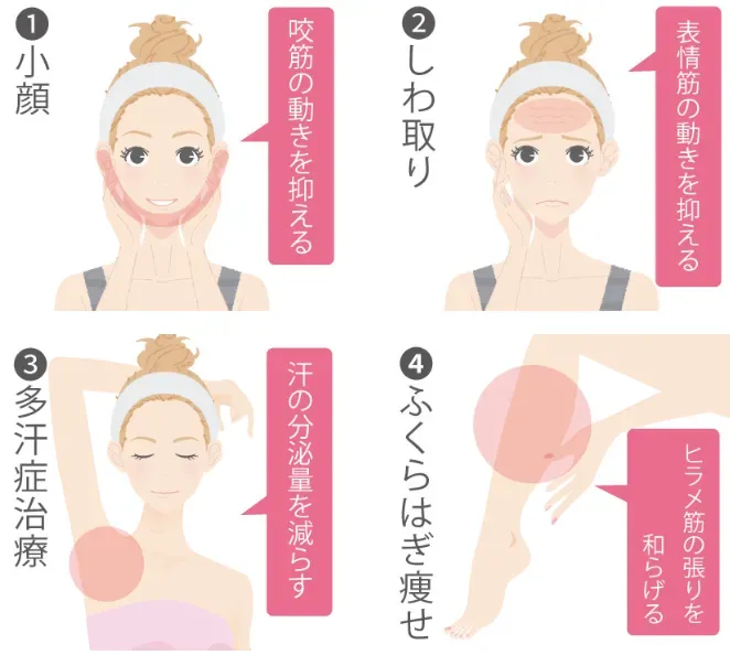 TCB　うまい先生のボトックスの効果