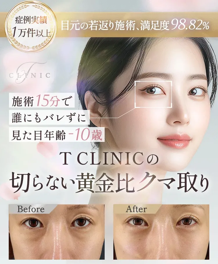 Tクリニッククマ取り