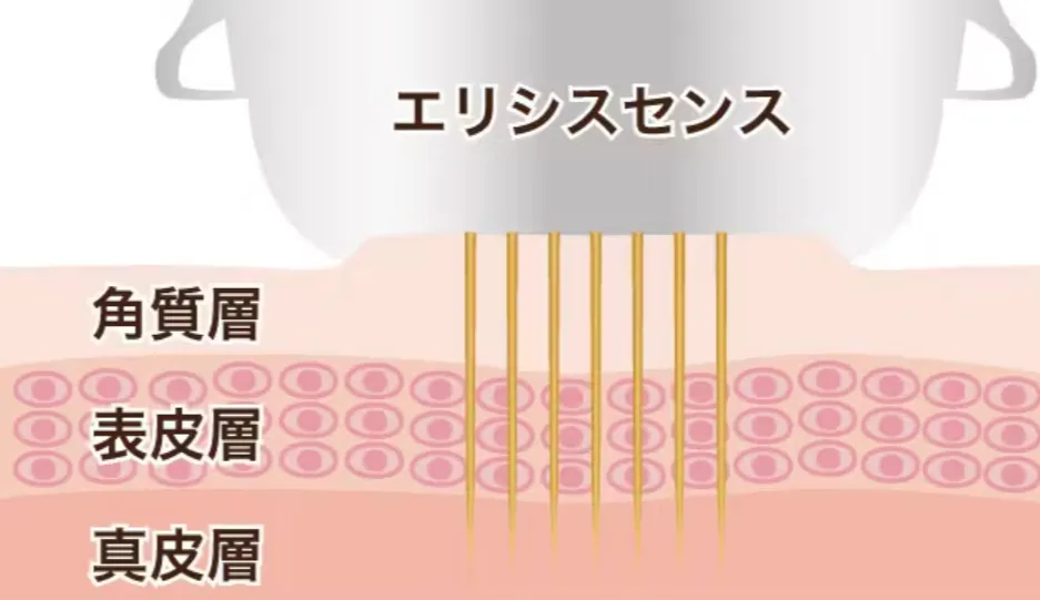 新潟の安いおすすめクリニック品川美容外科のエリシスセンス