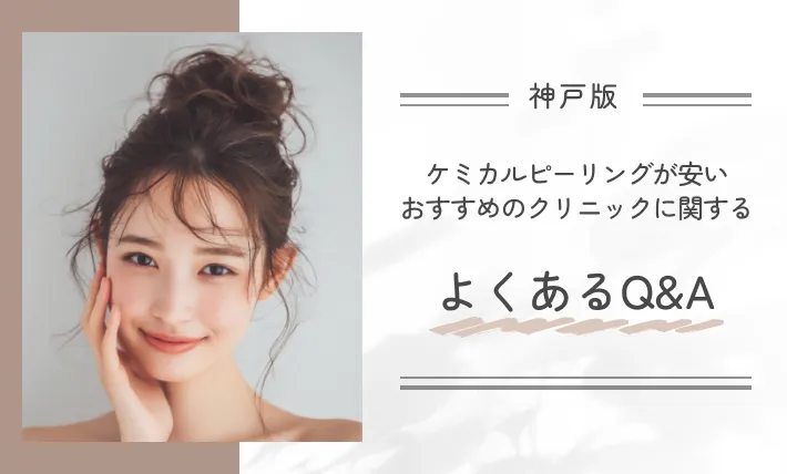 神戸でケミカルピーリングが安いおすすめのクリニックに関するよくあるQ&A