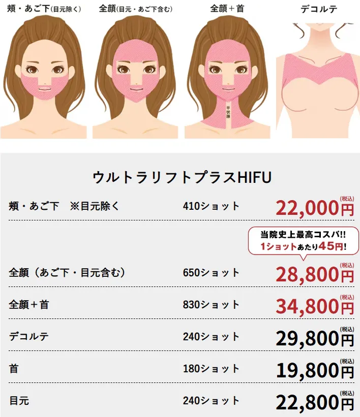 福岡で医療ハイフが安いおすすめ人気クリニック 湘南美容クリニックのLP画像 料金案内