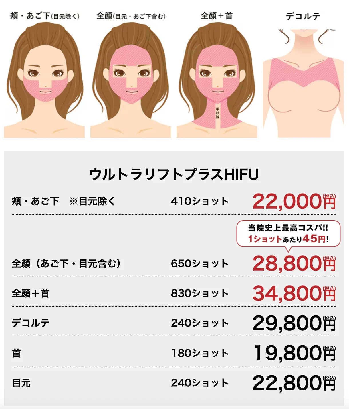 大阪で医療ハイフの安いおすすめ人気クリニック 湘南美容クリニックの料金